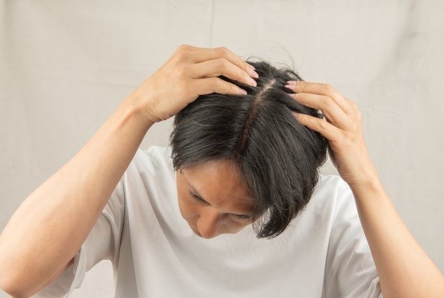 AGA(男性型脱毛症)のよくある質問